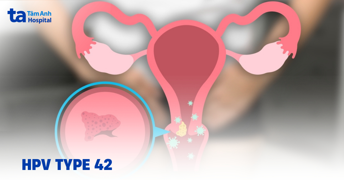 HPV type 42 là gì? Thuộc nhóm nào?