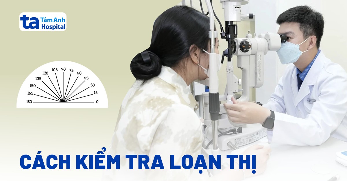 kiểm tra loạn thị