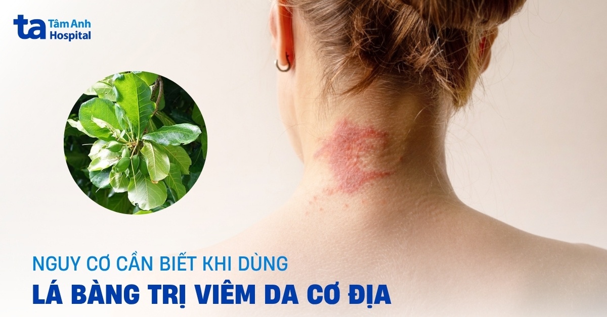 Lá bàng trị viêm da cơ địa: Thần dược hay nguy cơ tiềm ẩn?