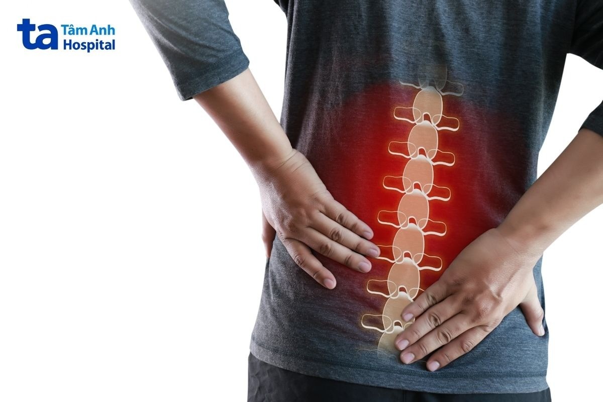 làm gì khi bị đau cột sống
