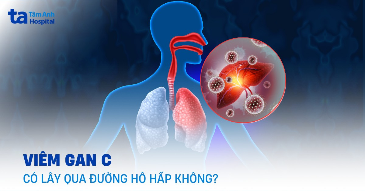 Viêm gan C có lây qua đường hô hấp không?