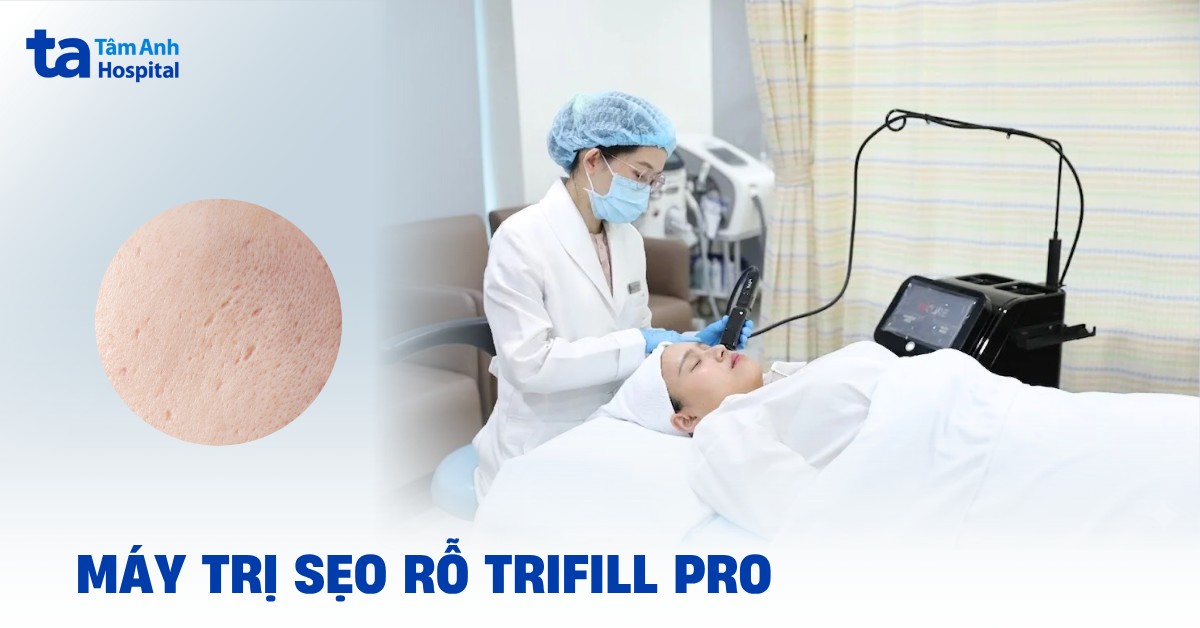 Máy Trifill Pro: Cơ chế hoạt động và công dụng nổi bật