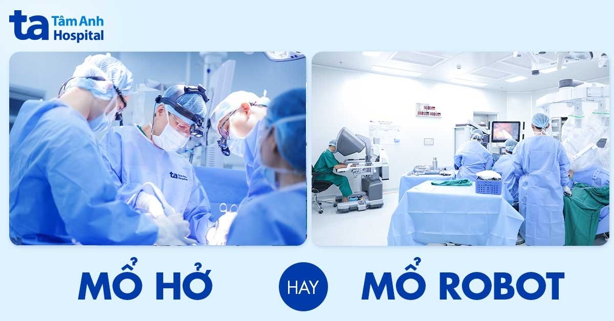 Mổ hở hay mổ robot: Nên chọn phương pháp nào?