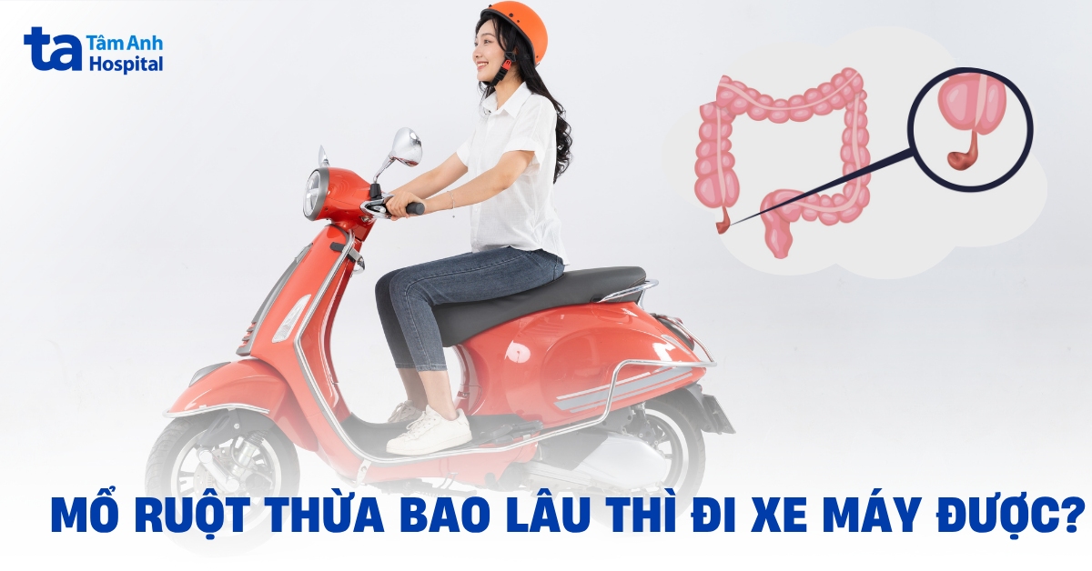 Mổ ruột thừa bao lâu thì đi xe máy được? Điều kiện an toàn