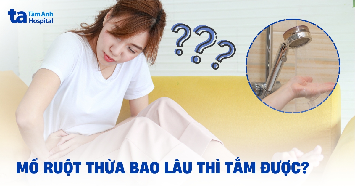 Mổ ruột thừa bao lâu thì tắm được? Lưu ý tránh nhiễm trùng
