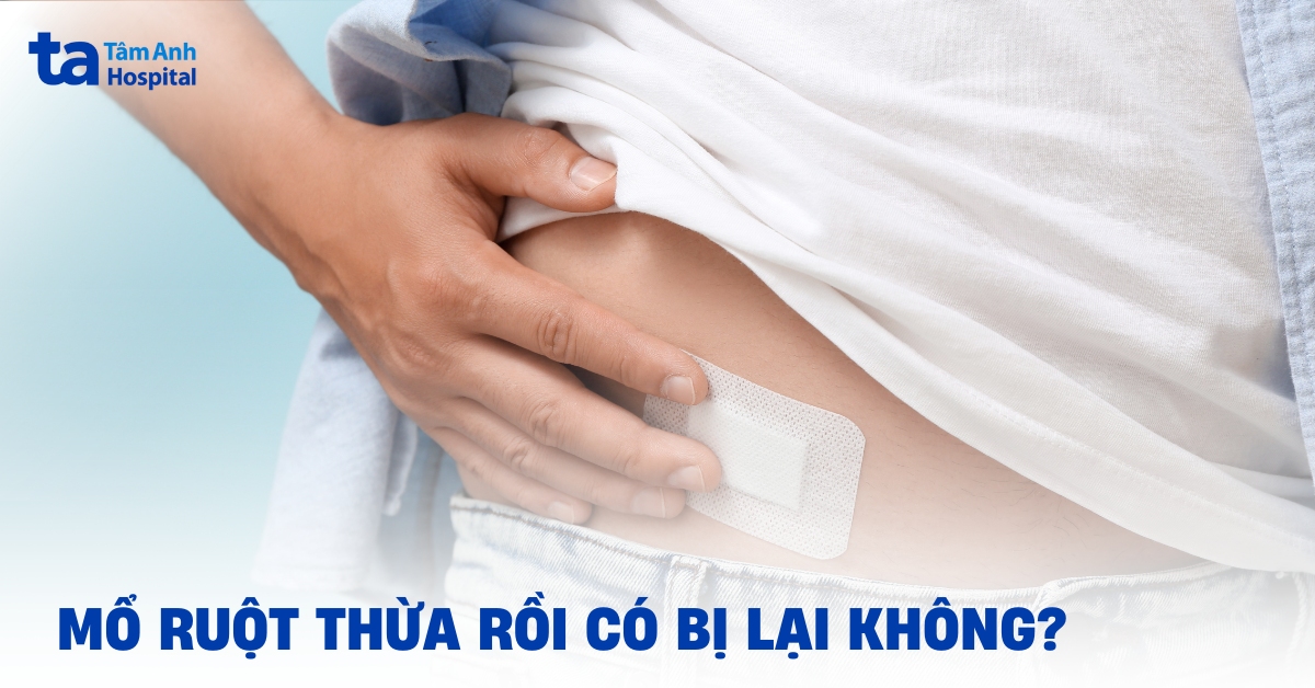 Mổ ruột thừa rồi có bị lại không? Hiểu đúng để tránh lo lắng