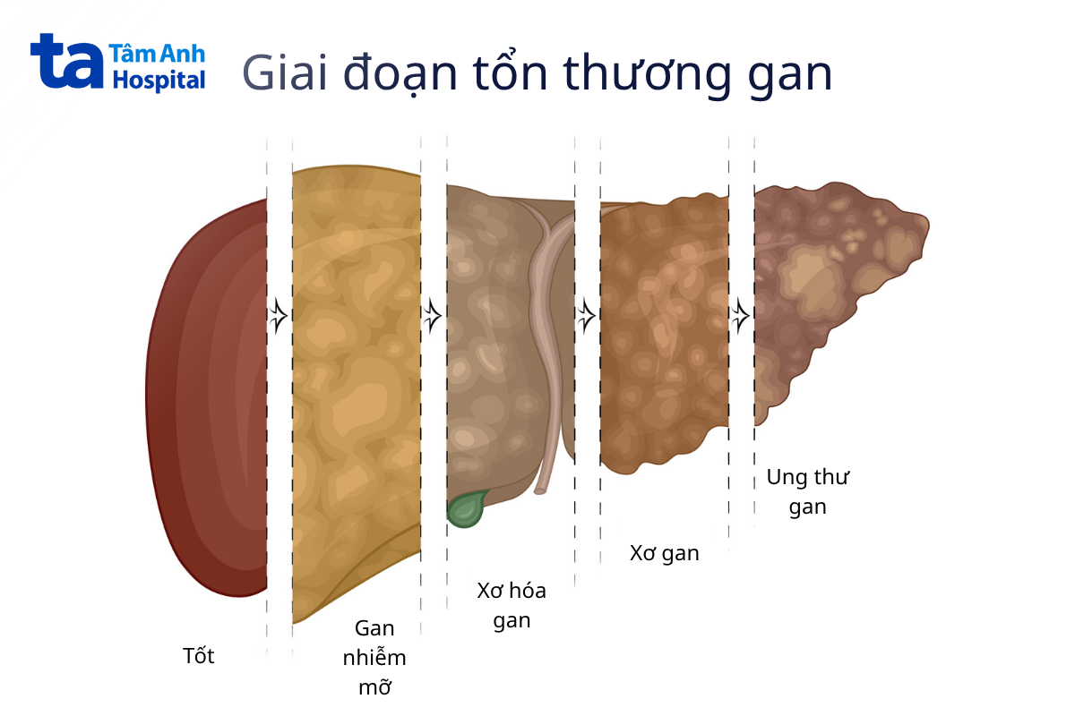 nhiễm đồng thời viêm gan c và b