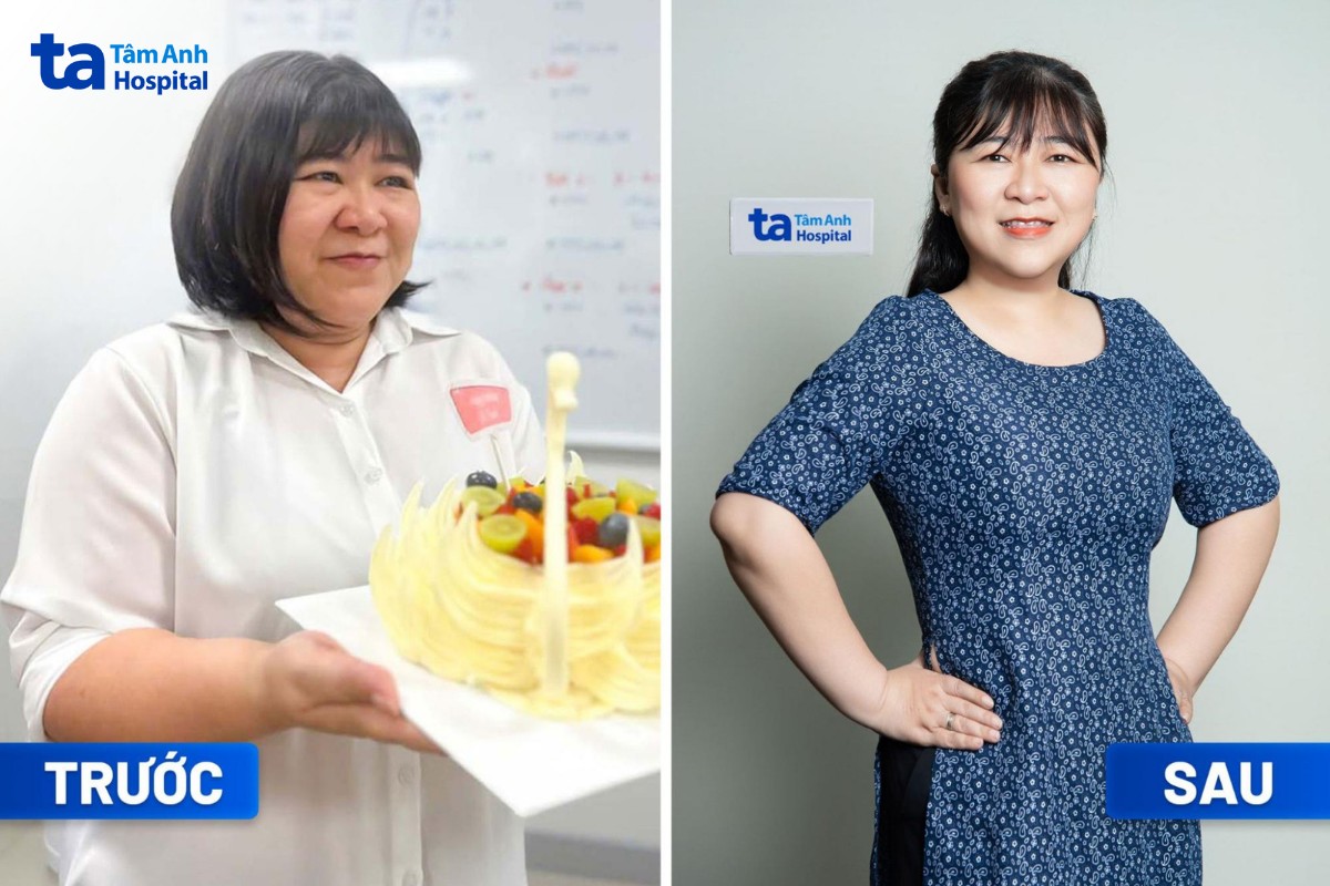 những loại chất xơ cần cho giảm cân