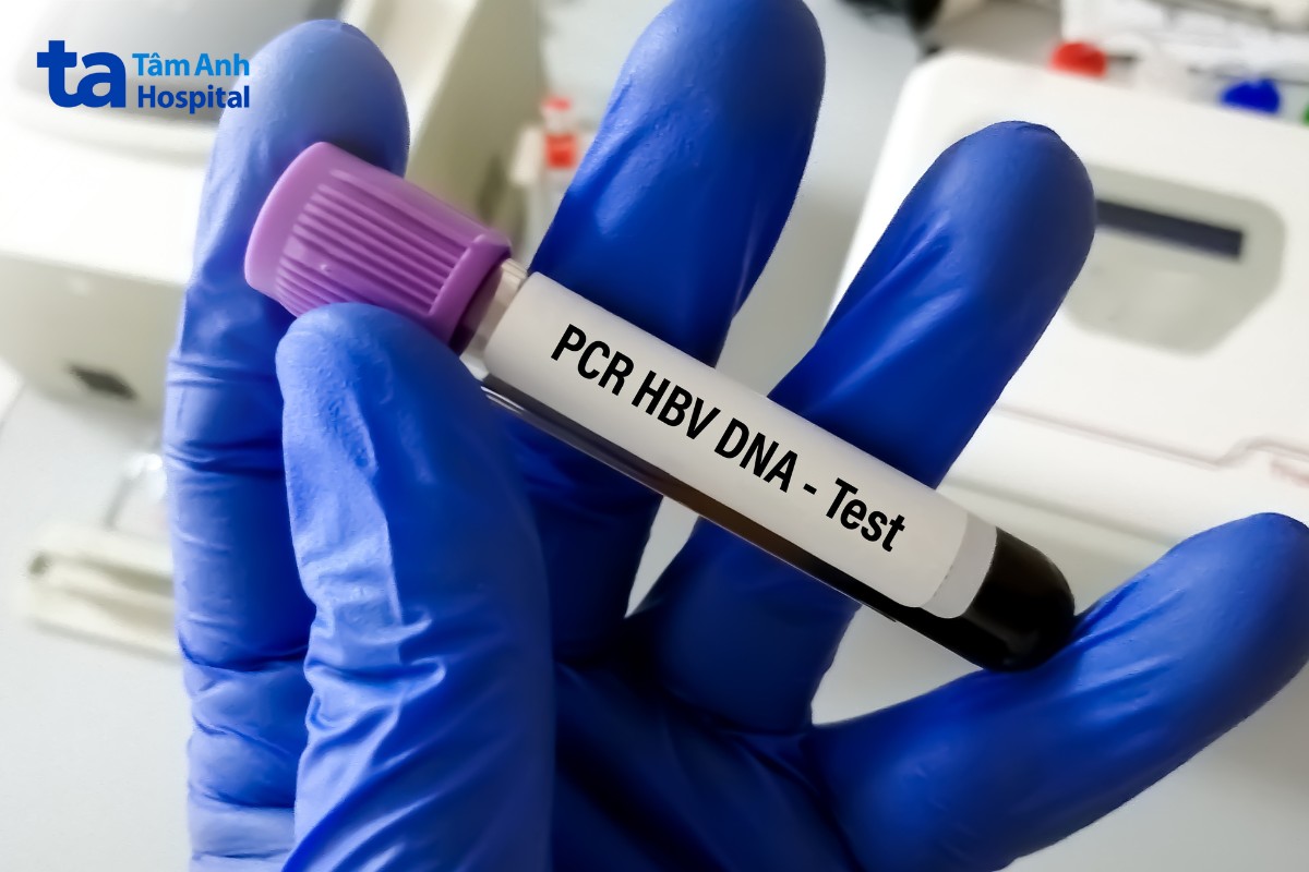 Định Lượng Virus Viêm Gan B Dưới Ngưỡng Phát Hiện Nồng Độ Virus Viêm Gan B Dưới Ngưỡng
