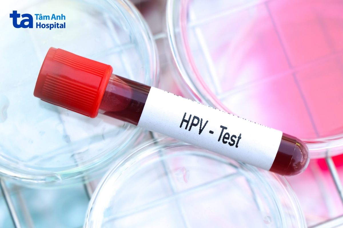 Ống mẫu xét nghiệm HPV đặt trong môi trường phòng xét nghiệm.