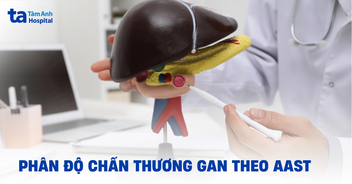 Phân độ chấn thương gan theo AAST: Ý nghĩa trong chẩn đoán và điều trị