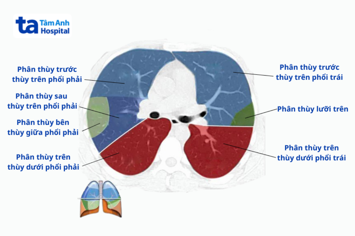 Phân Thùy Phổi Trên Phim Chụp Ct
