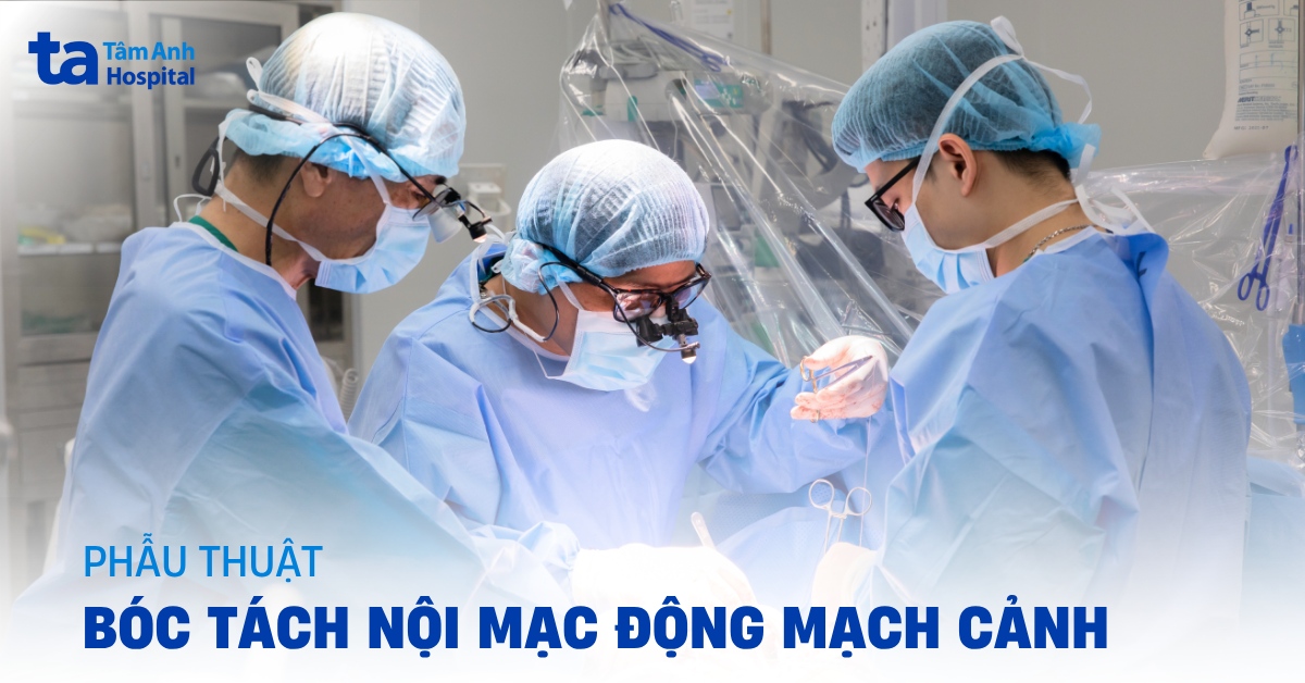 Phẫu thuật bóc nội mạc động mạch cảnh: Chỉ định và quy trình
