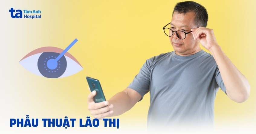 Phẫu thuật lão thị: Điều kiện, phương pháp, quy trình và chăm sóc