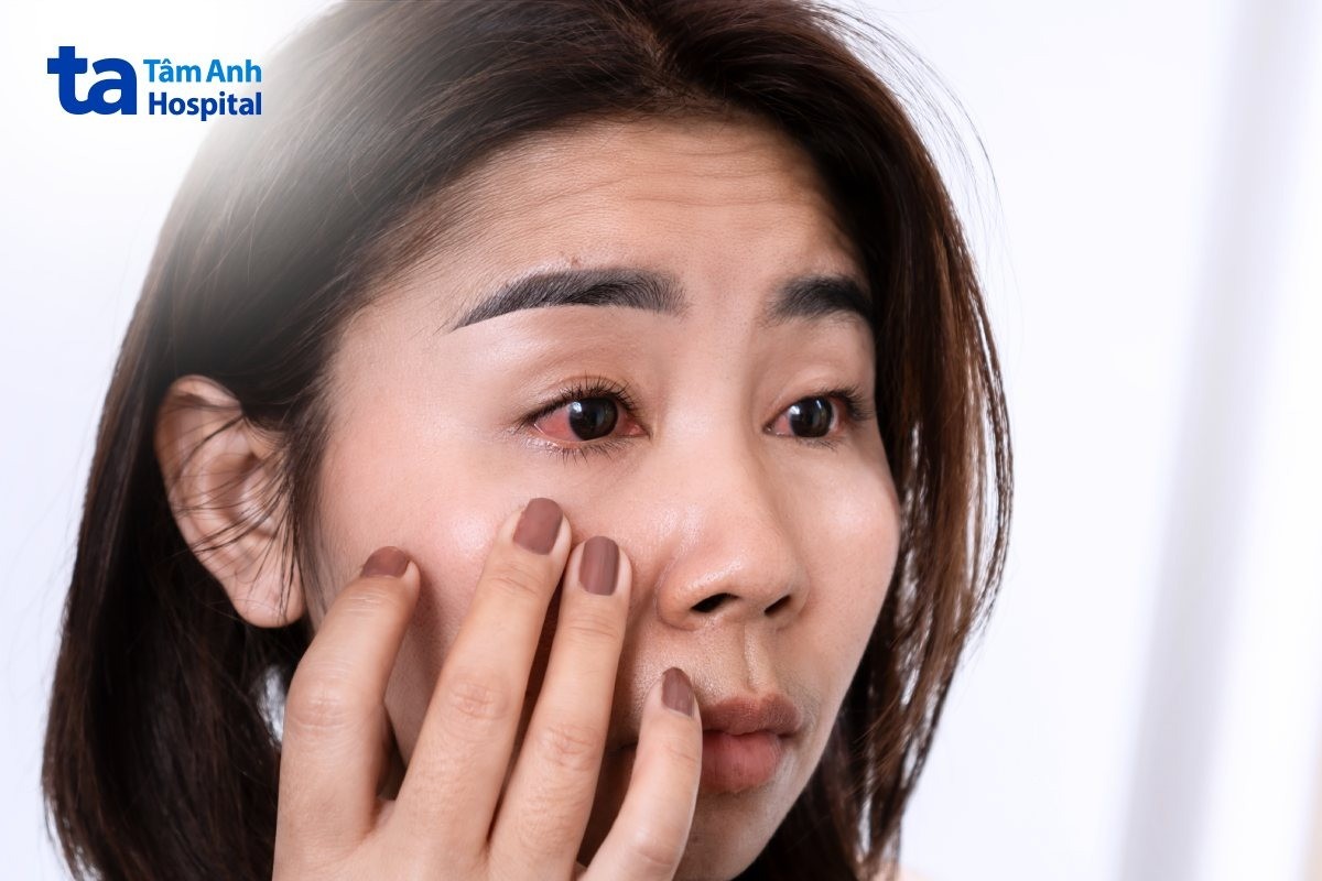 phù giác mạc là gì