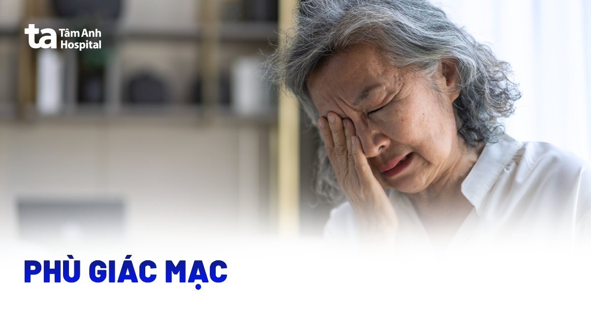 Phù giác mạc là gì? Đâu là hướng xử trí?