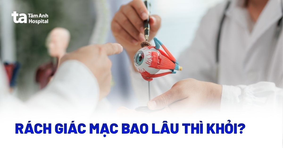 Rách giác mạc bao lâu thì khỏi? Có tự khỏi không?