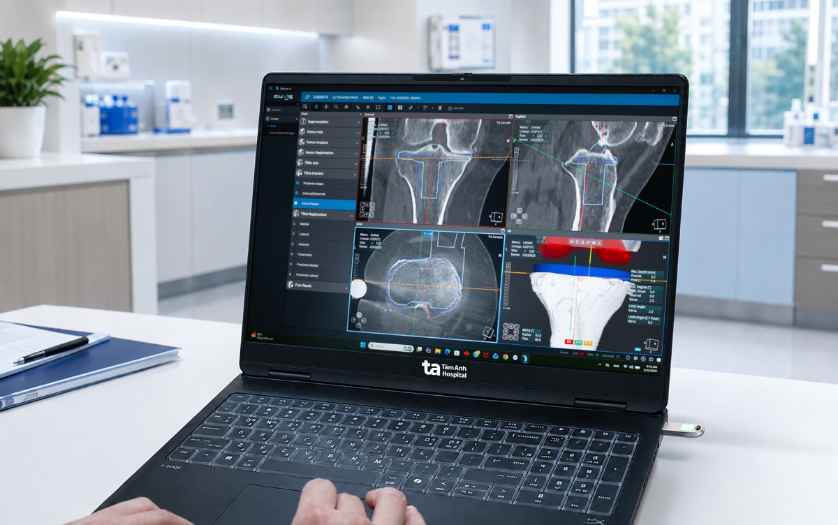 Bác sĩ sử dụng phần mềm chuyên dụng tích hợp trong robot AI CUVIS-Joint