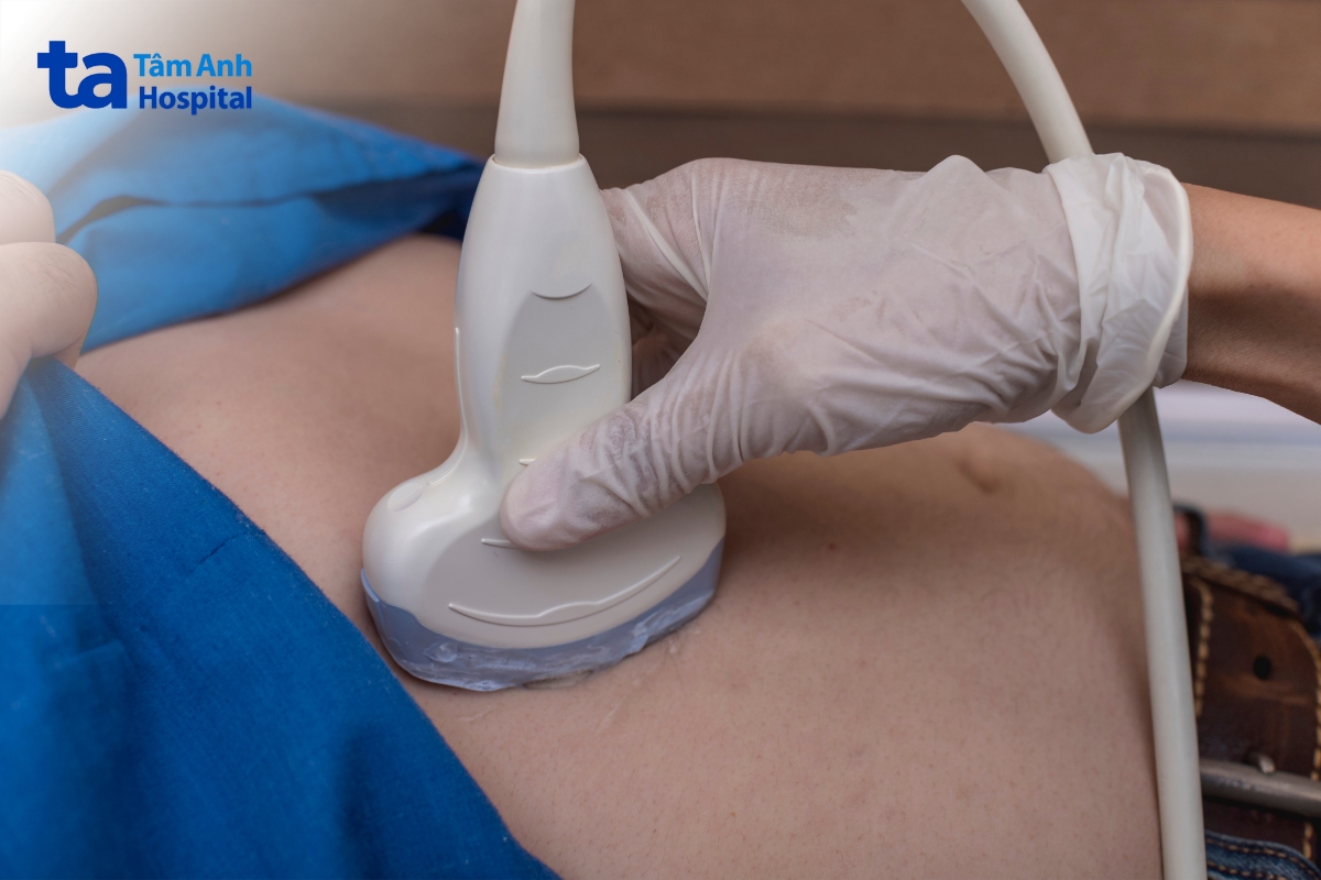 siêu âm gan nhiễm mỡ khu trú