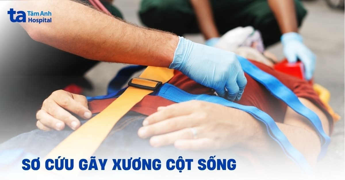 Hướng dẫn sơ cứu gãy xương cột sống và lưu ý cần biết