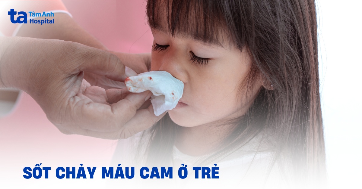 Sốt chảy máu cam ở trẻ do tác nhân nào gây ra?