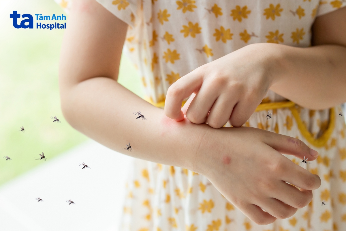 sốt xuất huyết tuy không gây ho, sổ mũi nhưng trẻ cần được nhập viện để theo dõi và điều trị