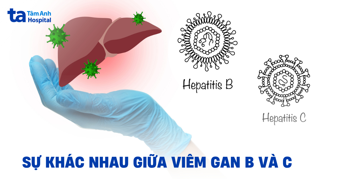 Phân biệt sự khác nhau giữa viêm gan B và C