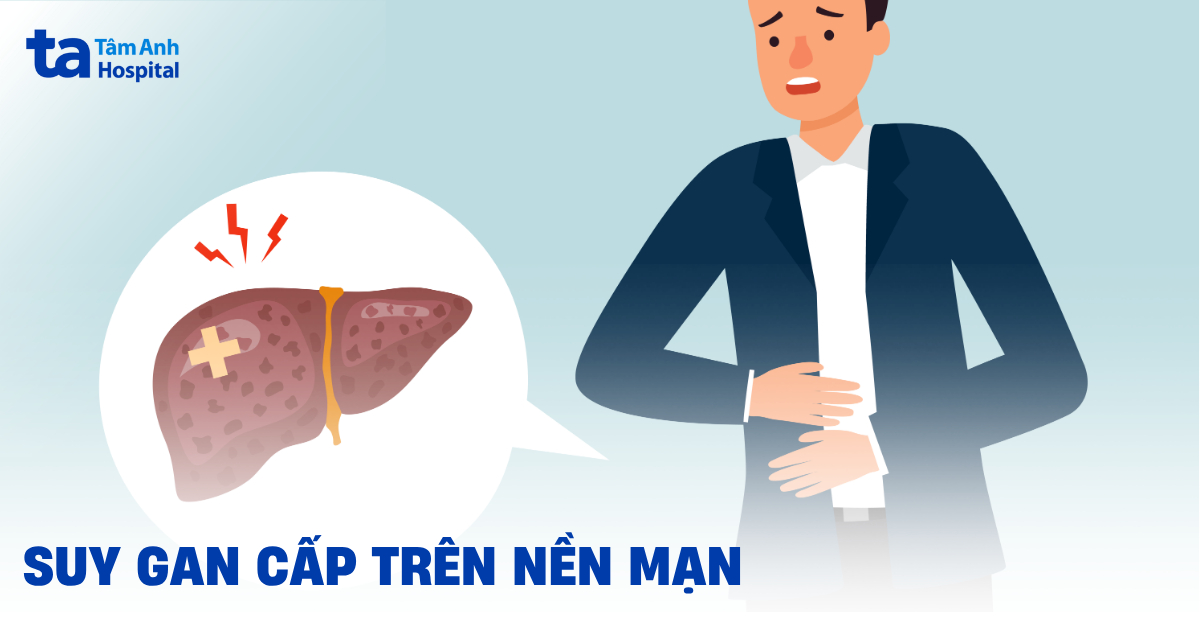 Suy gan cấp trên nền mạn (ACLF): Người bệnh cần chú ý