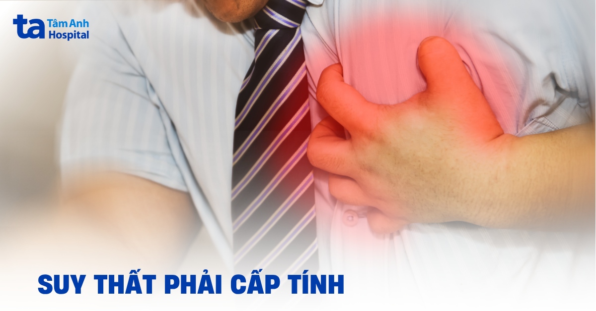 Tìm hiểu suy thất phải cấp tính là như thế nào?