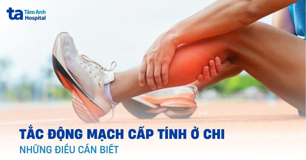 Tắc động mạch cấp tính ở chi là như thế nào?