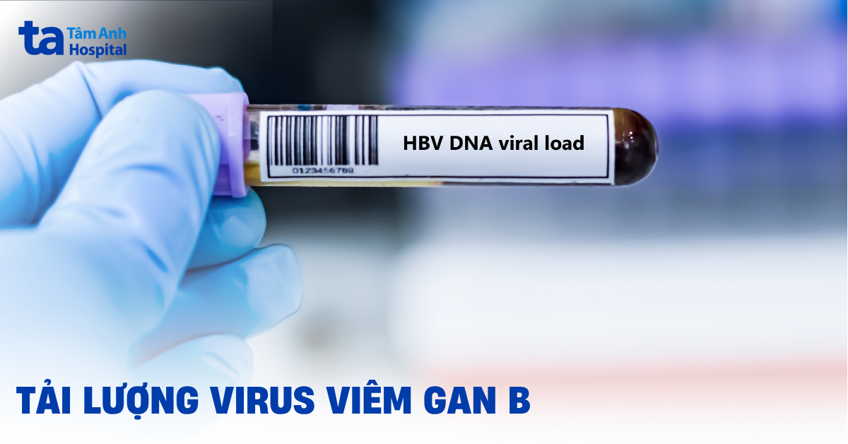 Tải lượng virus viêm gan B: Làm sao để kiểm soát?