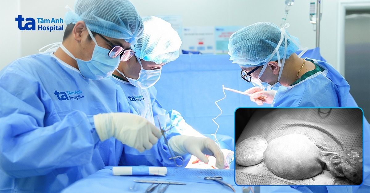 Thai phụ xoắn buồng trứng hai lần trong 4 ngày