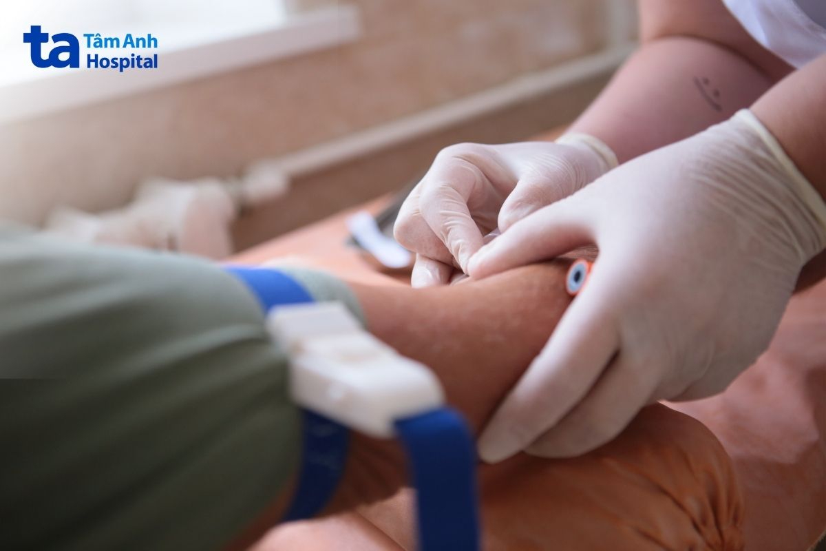 thăm khám nếu vàng da