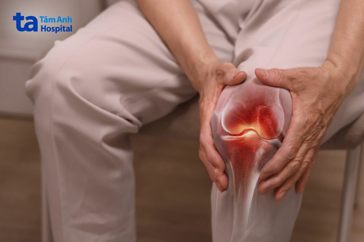 thấp khớp gây đau nhức