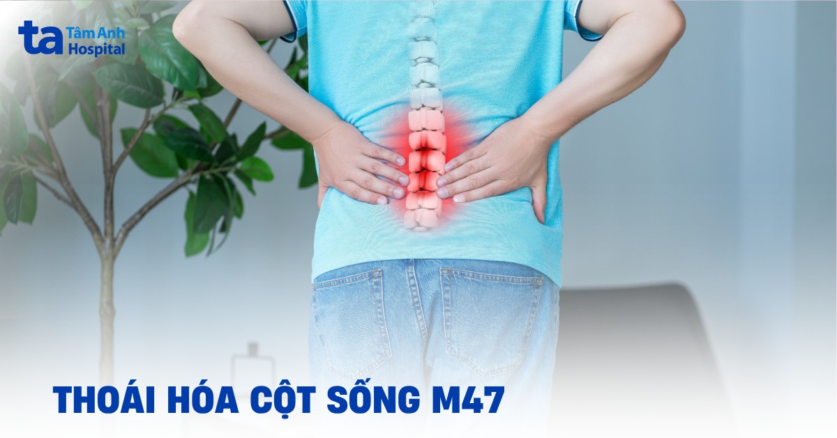 Cảnh giác với thoái hóa cột sống m47: Đâu là giải pháp?