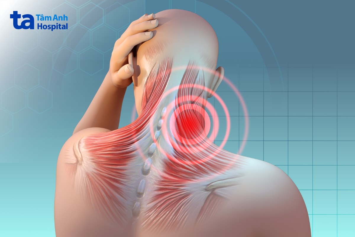 thoái hóa đốt sống cổ có gây ù tai không