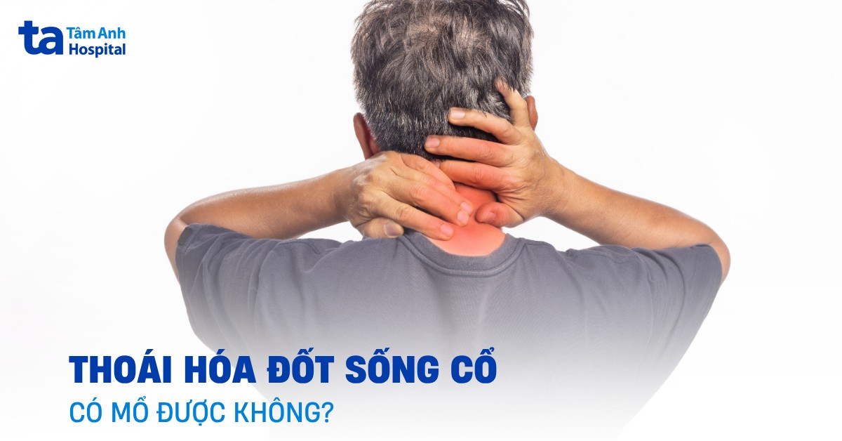 Thoái Hóa Đốt Sống Cổ Có Mổ Được Không​
