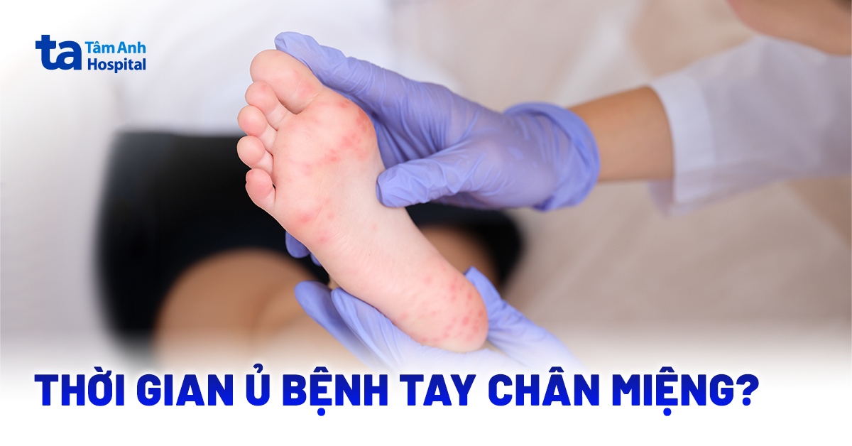 Thời gian ủ bệnh tay chân miệng bao lâu thì khởi phát?