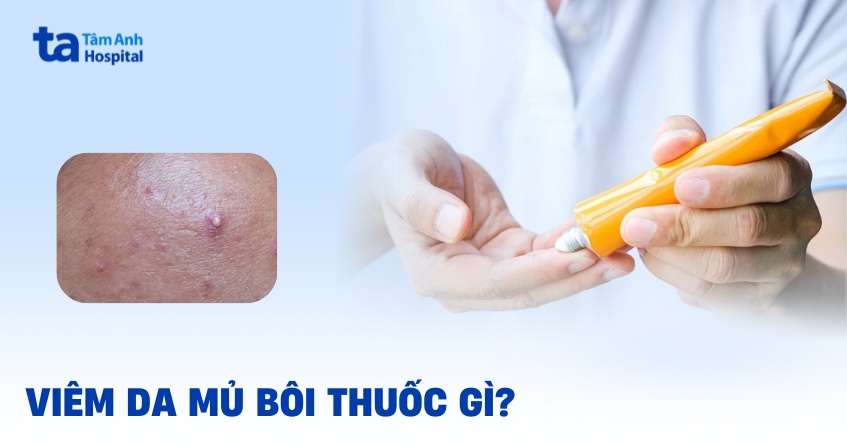 Làm sao để dùng thuốc bôi trị viêm da mủ cho hợp lý?
