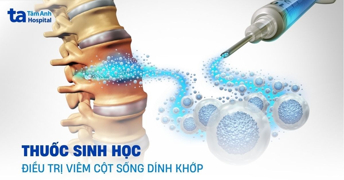 Các loại thuốc sinh học điều trị viêm cột sống dính khớp