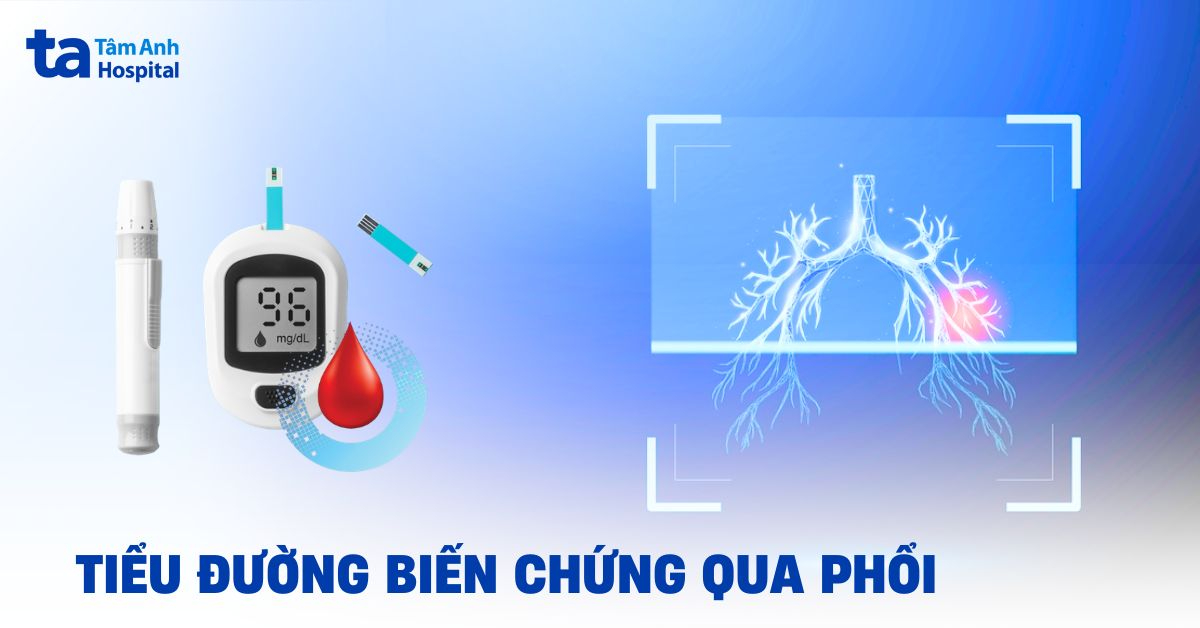 Tiểu đường biến chứng qua phổi làm tăng nguy cơ mắc bệnh gì?