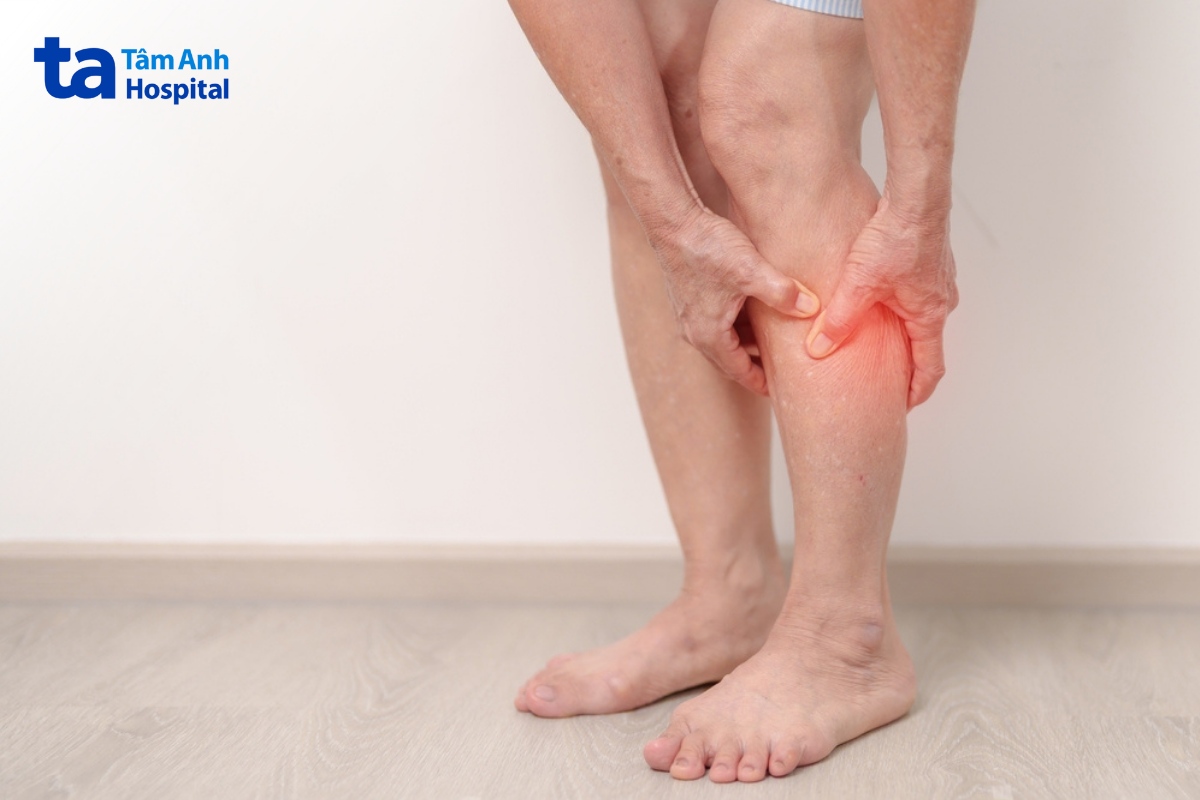 triệu chứng xơ cứng động mạch hay xơ vữa động mạch