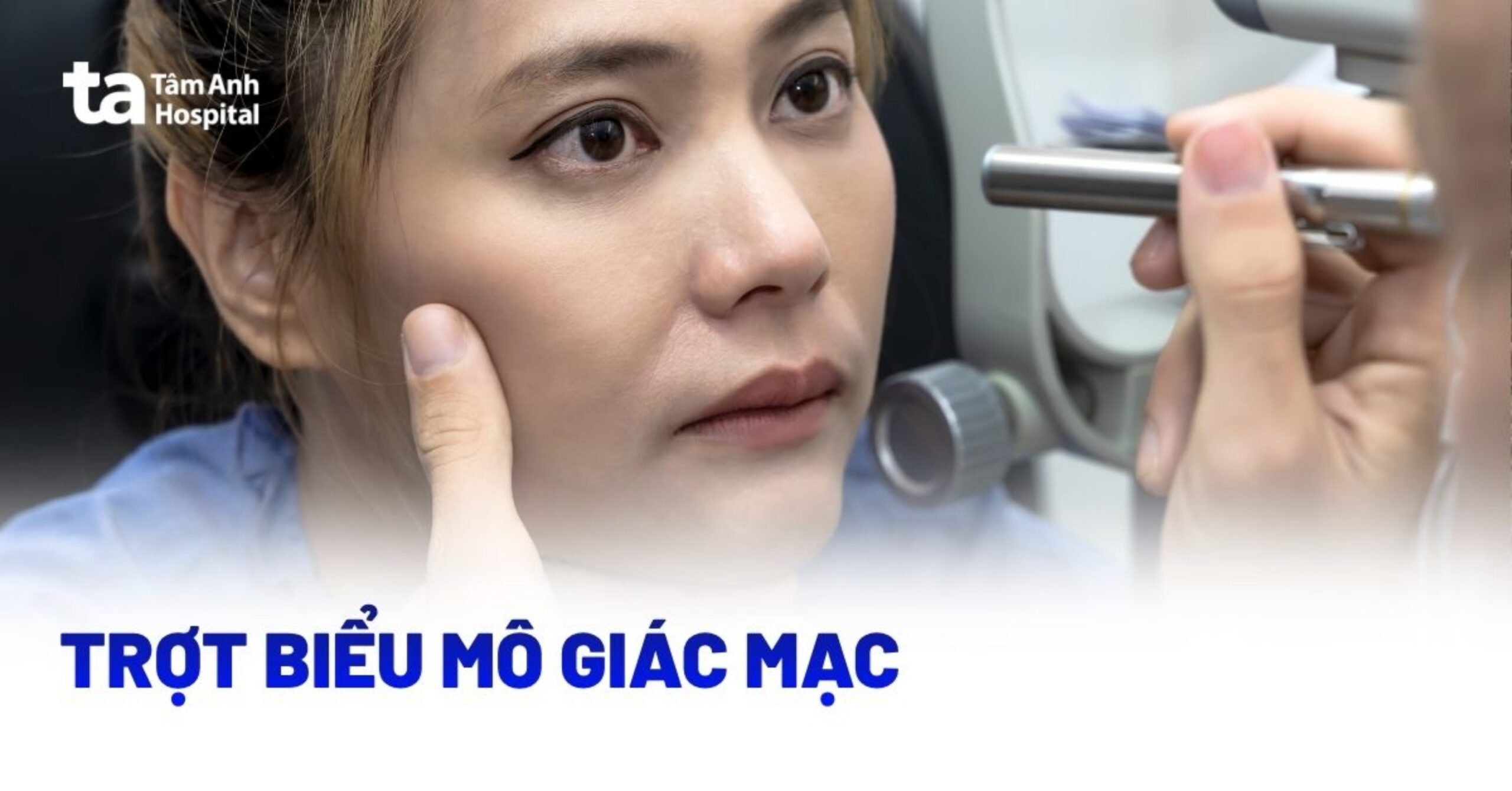 Trợt biểu mô giác mạc là tình trạng gì?