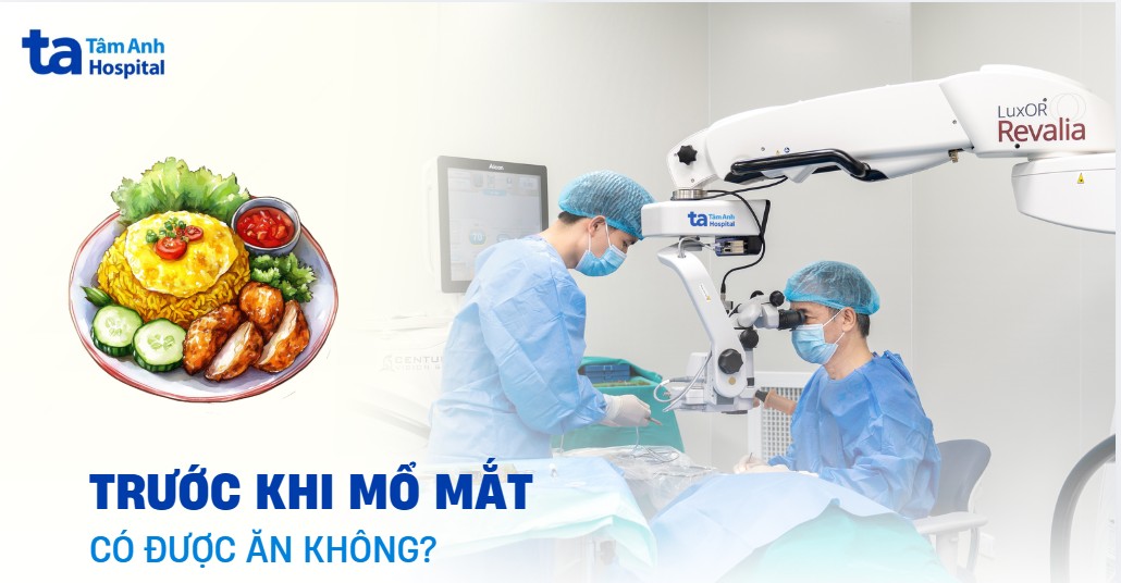 Trước khi mổ mắt có được ăn không? Nên ăn gì và kiêng ăn gì?
