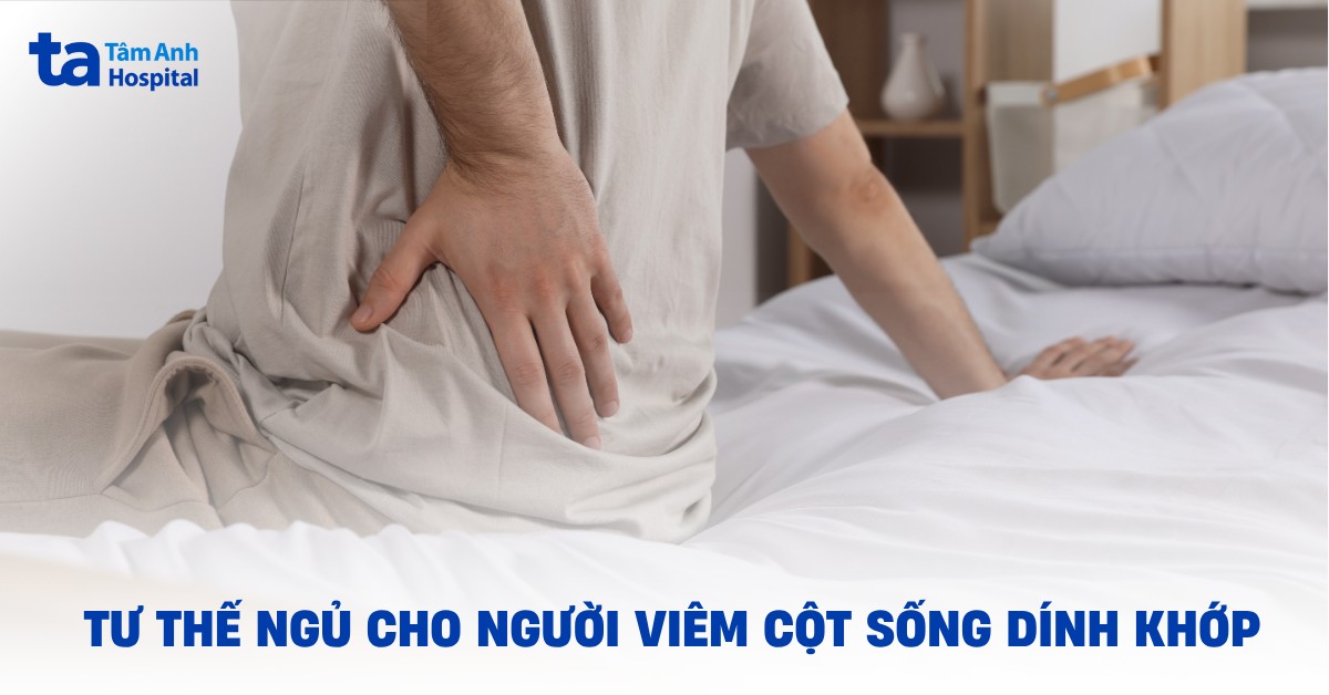 Tư Thế Ngủ Cho Người Viêm Cột Sống Dính Khớp