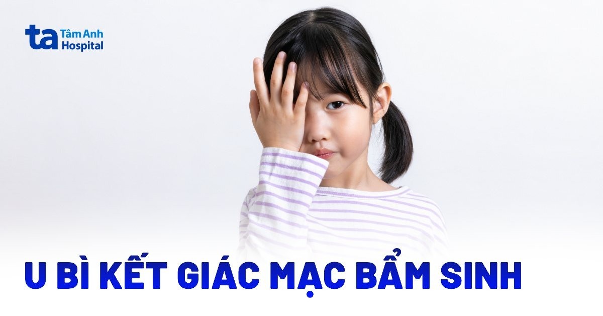 Tìm hiểu về u bì kết giác mạc bẩm sinh