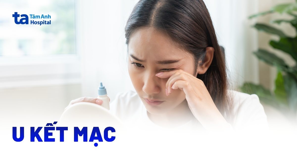 U kết mạc mắt là gì? Tìm hiểu các thông tin chi tiết