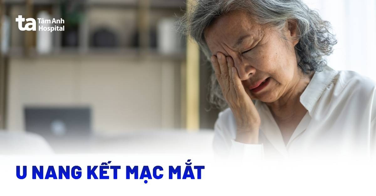 U nang kết mạc mắt và những điều cần biết