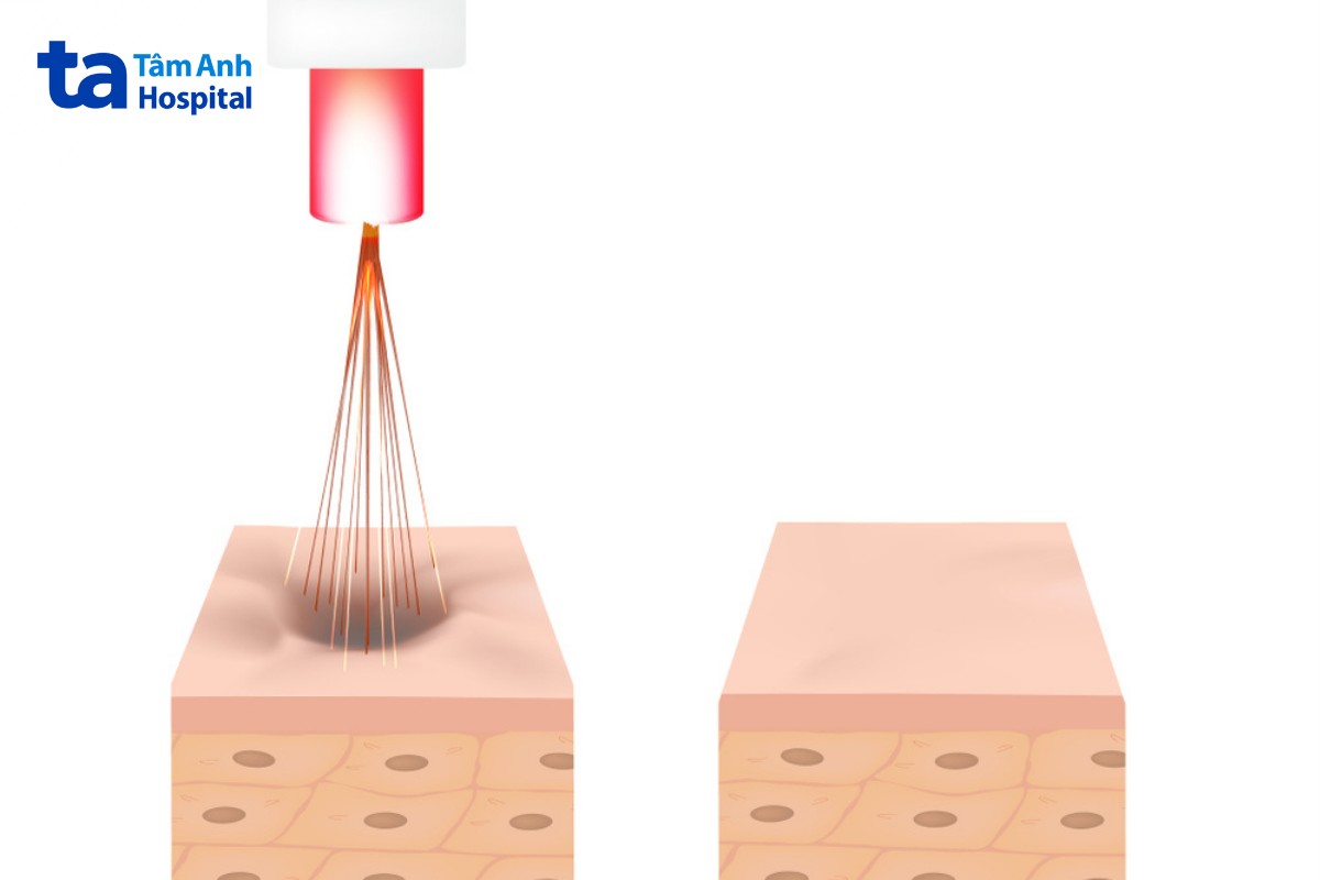 ứng dụng máy trifill pro