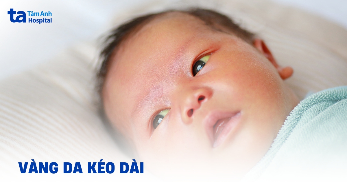 Vàng da kéo dài ở trẻ sơ sinh: Khi nào cần đưa trẻ đến bệnh viện?
